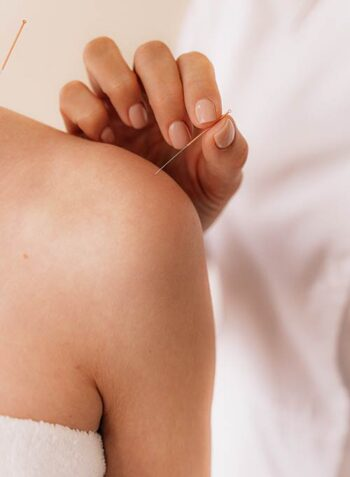 acupuncture shoulder